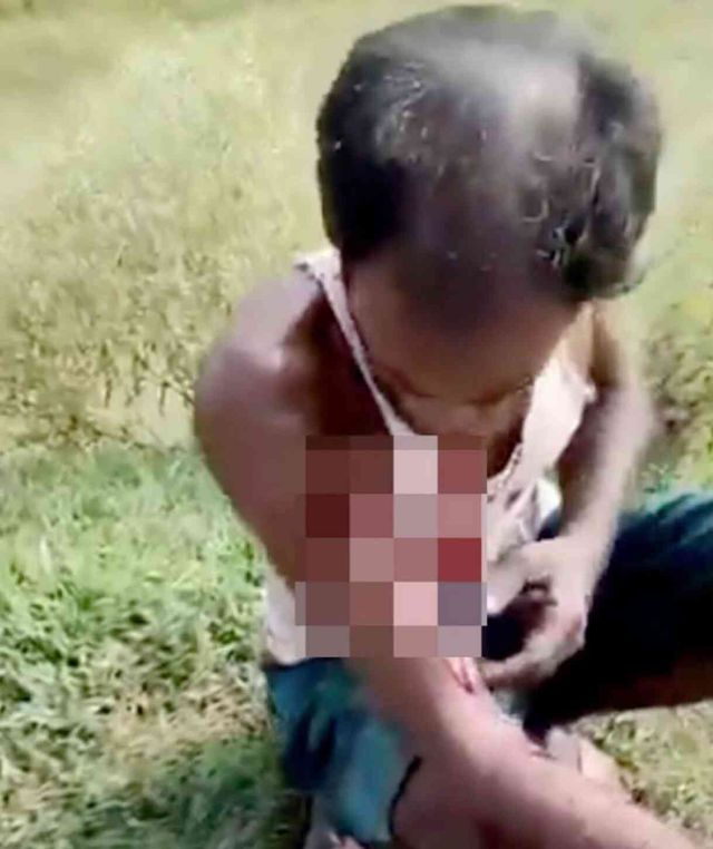 Hindistan'da çalılıklar arasında tuvaletini yaptığı sırada kaplan saldırısına uğrayan adam ağır yaralandı