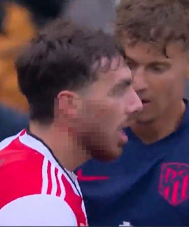 Feyenoord-Atletico Madrid maçında ortalık fena karıştı! Carrasco, milli futbolcumuzun boynunu kan içinde bıraktı