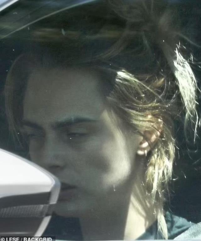 Cinsel ilişki ürünlerinin satıldığı mağazaya giren Cara Delevingne'ın bacağındaki morluklar dikkat çekti