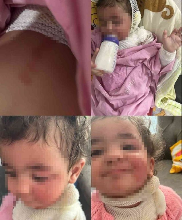 Kreşte 'kahve' faciası! Sapasağlam teslim ettiği bebeğini, yanıklarla teslim aldı