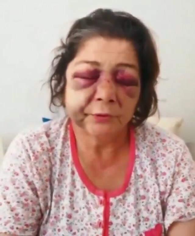 'Bakımsız park' tartışmasında oğlu ve gelini ile birlikte darp edildi (2)