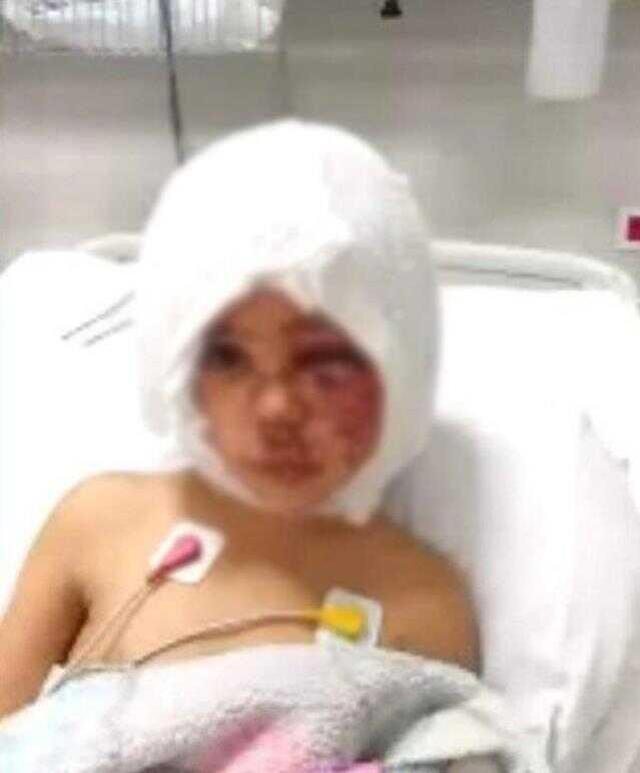 Rektör Özkan: 'Asiye'nin maalesef yüz felci var'