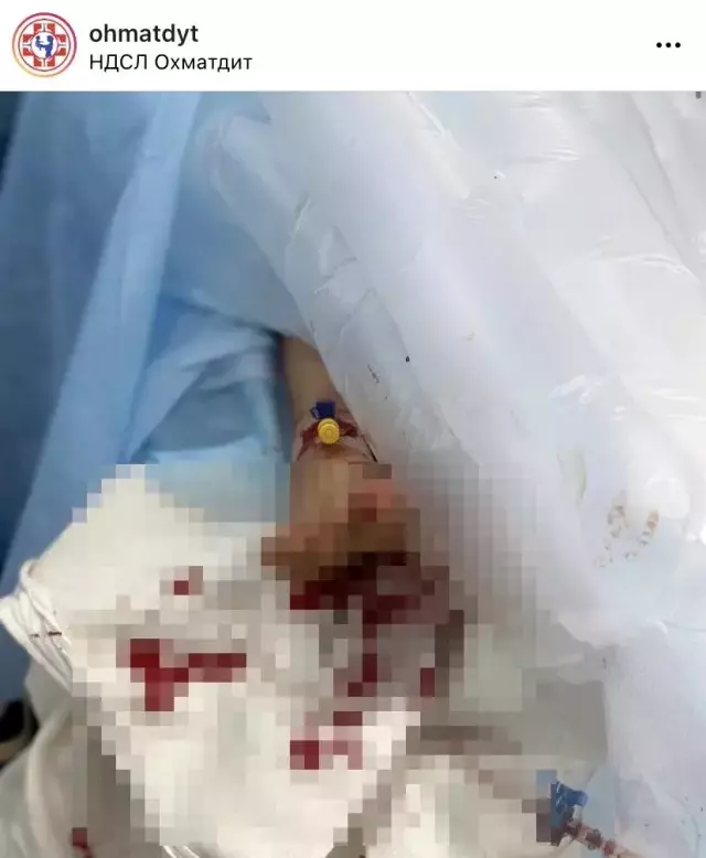 Savaşın korkunç yüzü! Rus bombalarıyla ağır yaralanan çocuğun fotoğrafları yürek parçaladı