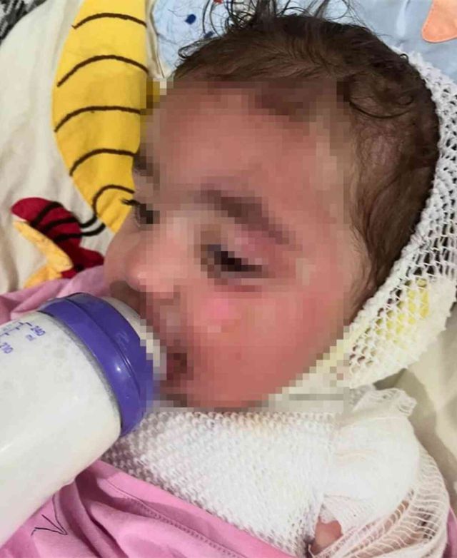 Kreşte 'kahve' faciası! Sapasağlam teslim ettiği bebeğini, yanıklarla teslim aldı