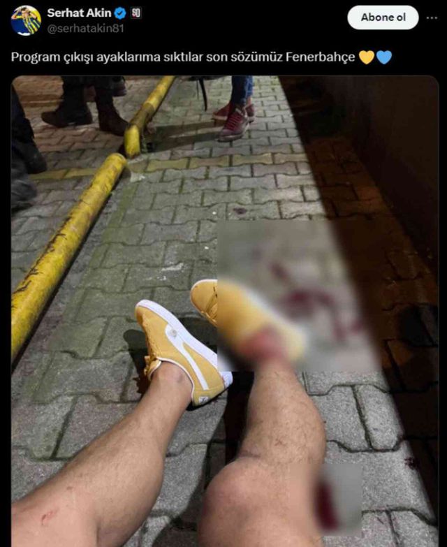 Serhat Akın vuruldu mu, kim vurdu?