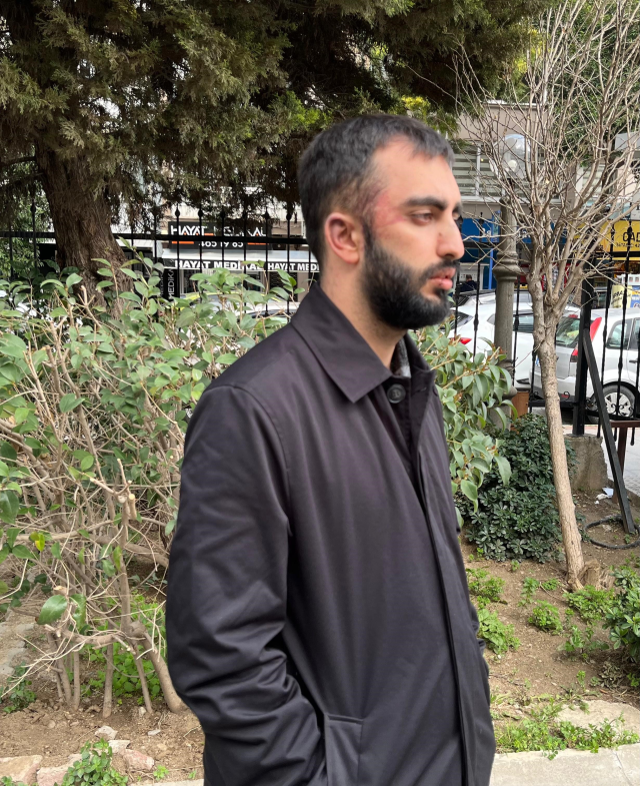 Önce başıboş köpekler saldırdı, sonra sahipleri feci şekilde darbetti