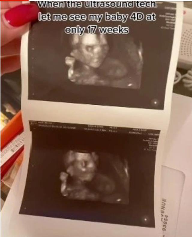 Ultrason fotoğraflarına bakan anne, bebeğinin ürkütücü yüzüyle karşılaştı