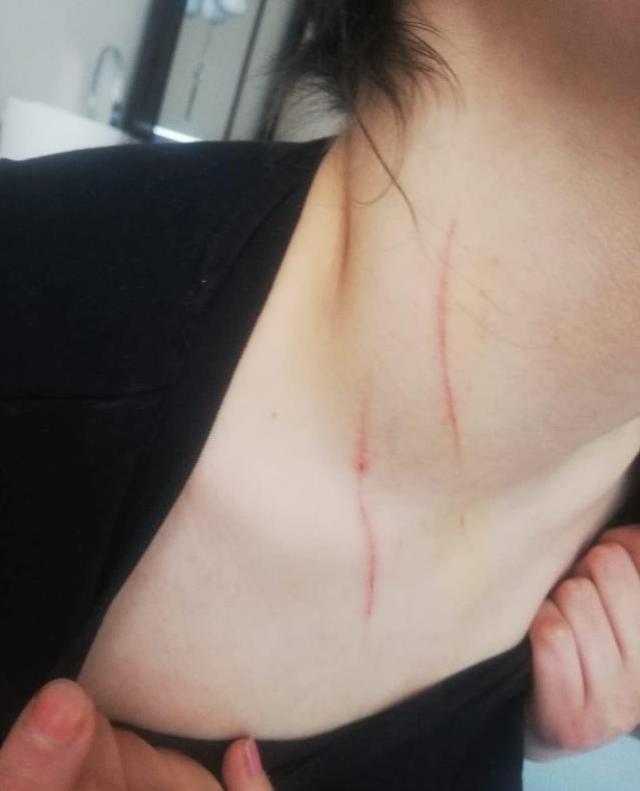 Bıçak zoruyla kaçırılan genç kız yaşadığı dehşeti böyle anlattı: Beni çırılçıplak soyup cinsel istismarda bulundular