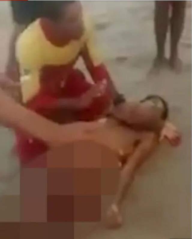 Korkunç görüntüler! Sudan bir anda fırlayan köpek balığı, yüzen gencin penisini parçaladı