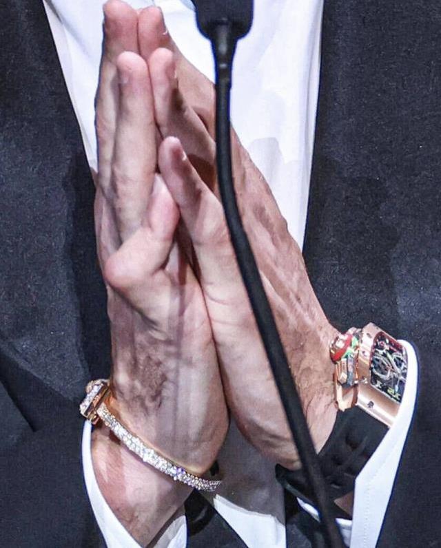 Benzema'nın eli bandajsız görüntülendi! Serçe parmağının halini görenler gözlerine inanamadı