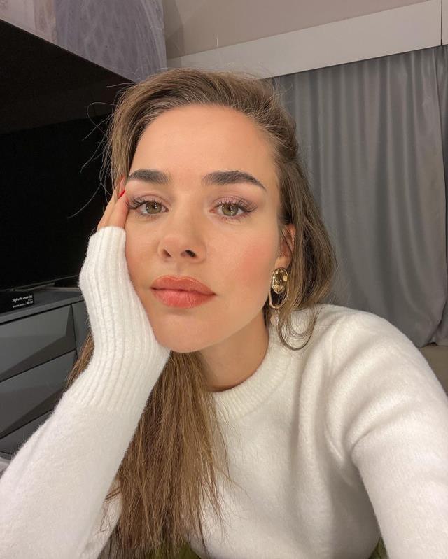 Oyuncu Bensu Soral estetik yaptırdı, son hali kimse beğenmedi