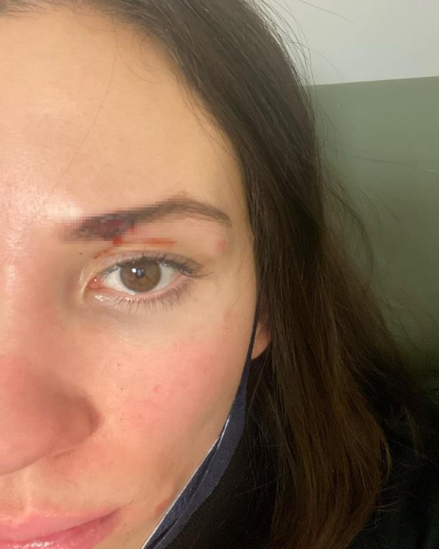 Özer Hurmacı'dan şiddet gördüğünü söyleyen eşi konuştu: 3 çocuk ve evin giderleri için 500 TL gönderiyor