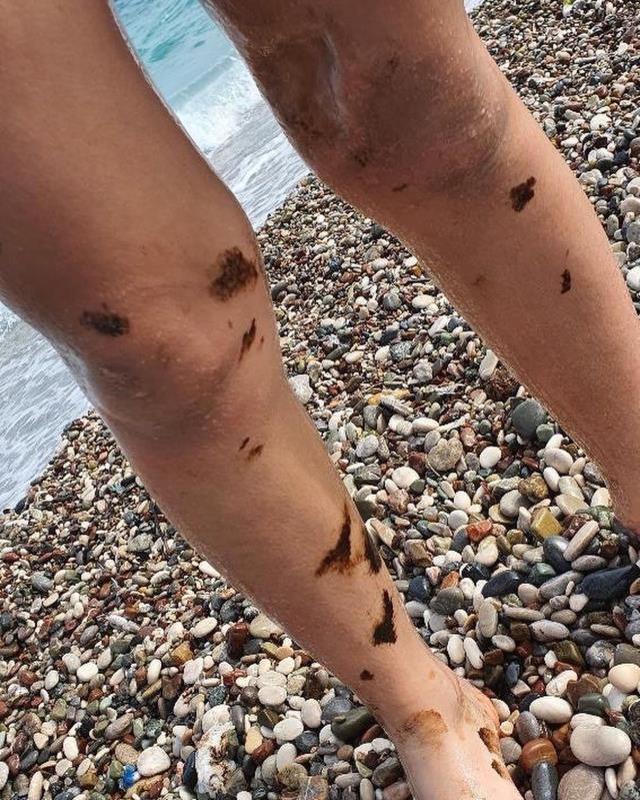 Antalya sahilleri zifte teslim! Denize giren vücudunda siyah lekelerle çıkıyor