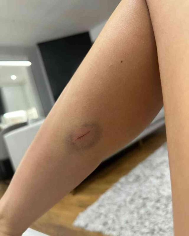 Fenomen Merve Taşkın, eski sevgilisi tarafından öldüresiye dövüldü: Cinsel organımı tekmeliyordu