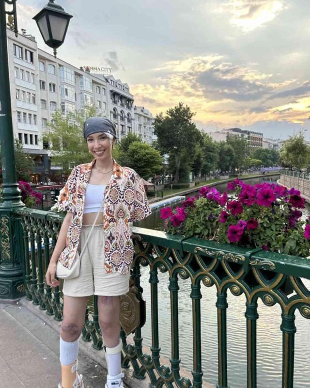 Depremde kolunu kaybeden yeğenini düğününde yalnız bırakmadı