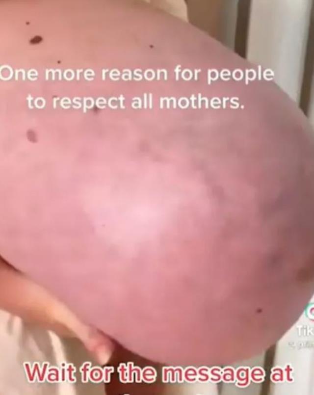 Üçüzlere hamile kalan kadının karnının görüntüsü izleyenleri hayret ettirdi