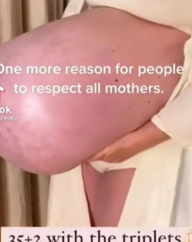 Üçüzlere hamile kalan kadının karnının görüntüsü izleyenleri hayret ettirdi