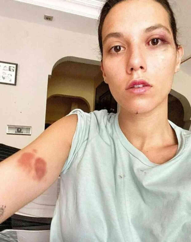 Ozan Güven'e 'kasten yaralama' suçundan hapis cezası