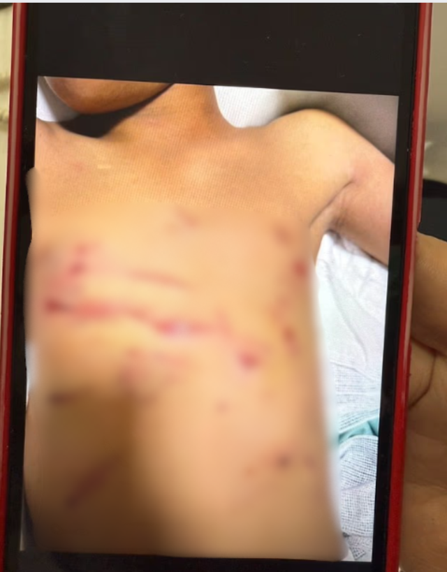 Zincirlerinden kurtulan aslan, 11 yaşındaki çocuğu ağır yaraladı