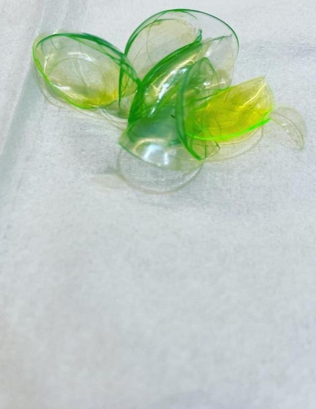 Gözündeki aşırı kaşıntı için hastaneye giden kadın, doktorun dudağından dökülen sözlerle hayatının şokunu yaşadı