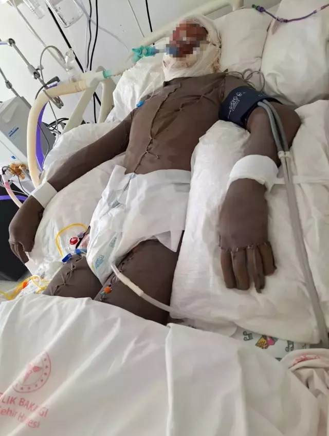 Görüntü Türkiye'den: 16 yaşındaki çocuk, 15 yaşındaki iş arkadaşını ateşe verdi