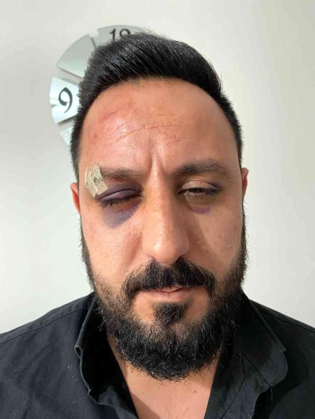 Son dakika haberleri: 'Kime geldiniz' dedi öldüresiye dayak yedi: Apartman içindeki dehşet anları kamerada