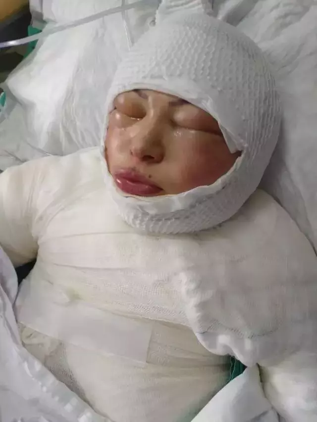 Eski eşi tarafından ateşe verilen talihsiz kadından kan donduran sözler: Söndürmeye çalışmadı, yanmamı izledi