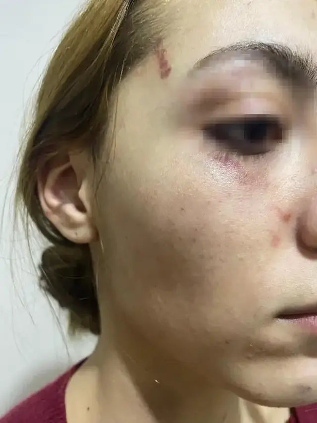 Eşofmanı yüzünden terk edildi, barışma teklifini kabul etmeyince öldüresiye dövüldü