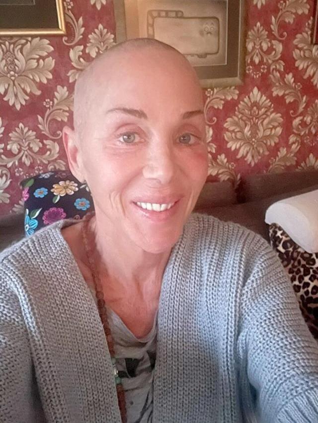 Kansere yakalanan Billur Kalkavan, hastalığı nasıl öğrendiğini anlattı