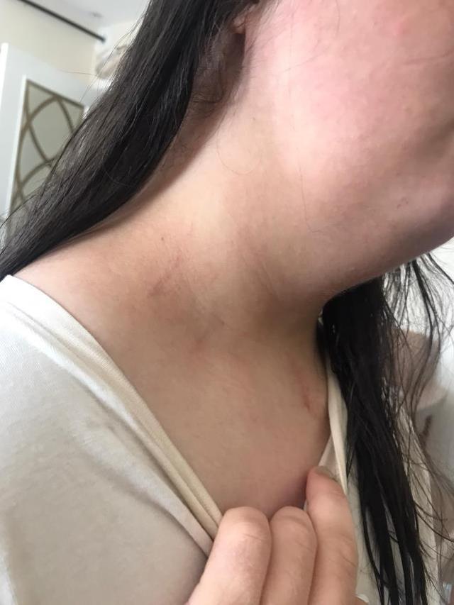 Düğünde 'saça dokunma' kavgası kötü bitti! Down sendromlu kız darp edildi, 1 kişi vuruldu