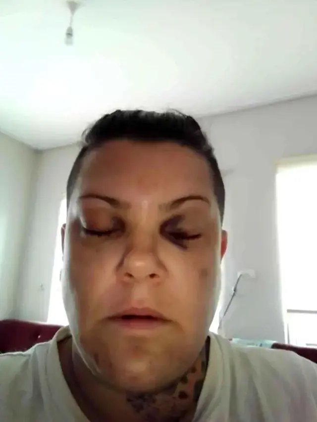 Eski Popstar yarışmacısı Evren Mevlanaoğlu, evinin önünde darp edildi