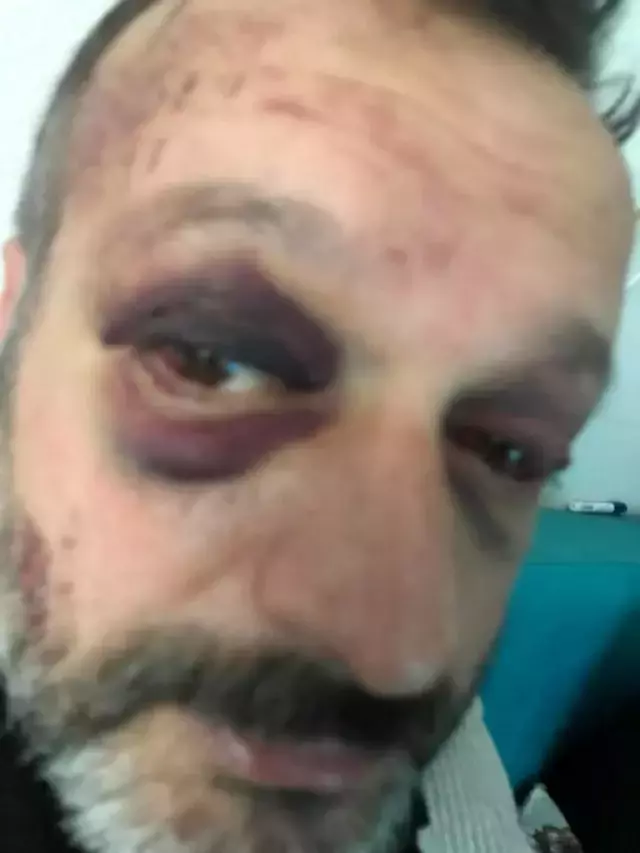 Bir istek cinneti de Bursa'dan! 'Çalacağım' demesine rağmen dinlemeyip dövdüler