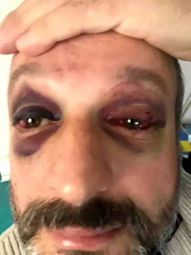 Bir istek cinneti de Bursa'dan! 'Çalacağım' demesine rağmen dinlemeyip dövdüler