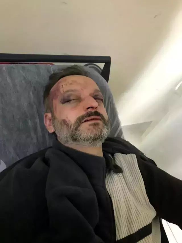 Bir istek cinneti de Bursa'dan! 'Çalacağım' demesine rağmen dinlemeyip dövdüler