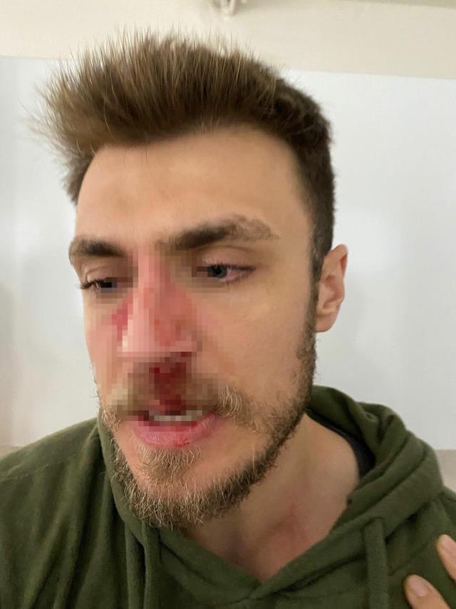 Erkek doğum uzmanını 'Karıma ne bakıyorsun' sözlerinin ardından dövmüş