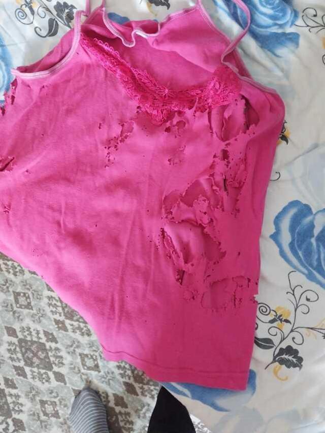 Lavabo açıcı bomba gibi patladı! Kıyafetleri pul pul dökülen genç kadın acılar içinde hastaneye koştu