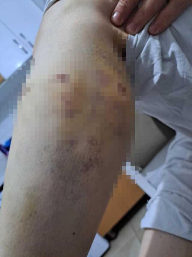 İmamoğlu'nun danışmanı Murat Ongun'un 'Thor' isimli köpeği belediye çalışanına saldırdı