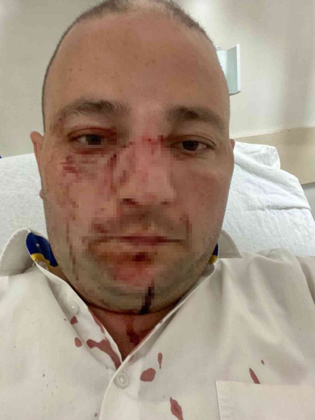 Bu nasıl öfke! Otobüsün farından rahatsız olan baba-oğul, şoförü darp etti