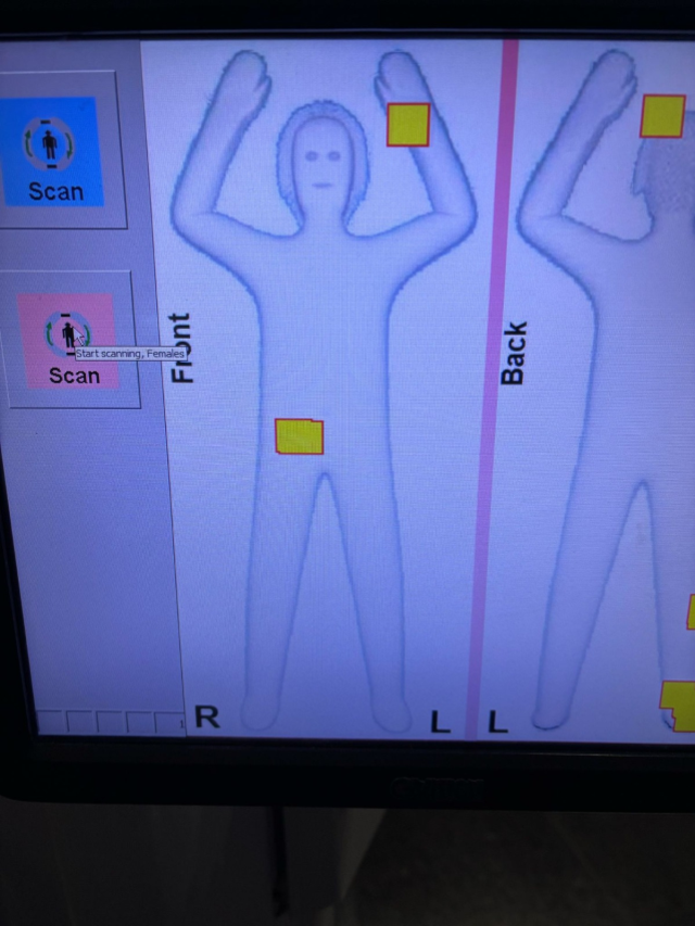 İstanbul Havalimanı'nda 3 kadının cinsel organlarından kilolarca altın çıktı