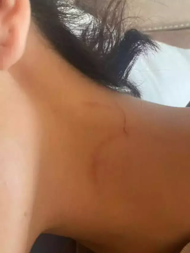 Can Yaman'ın sevgilisi Sara Bluma şiddet gördüğünü açıkladı