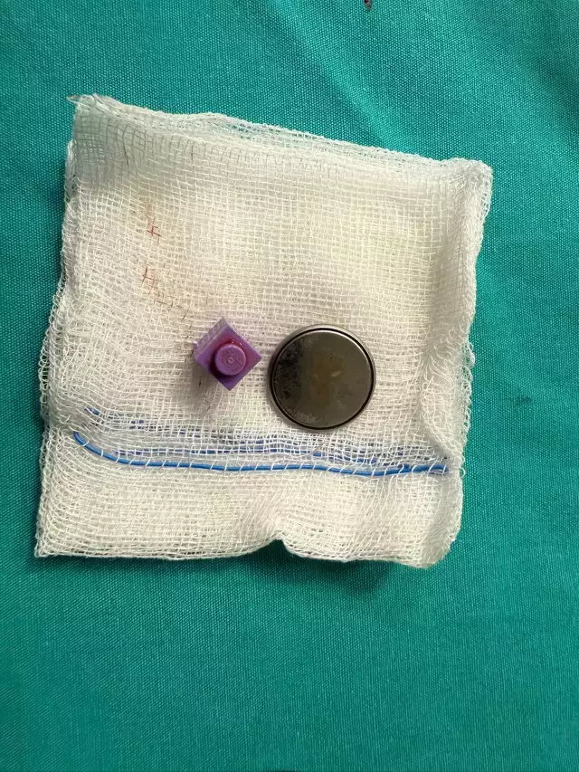 Kardeşi fark etti, hastaneye koştular! 15 aylık bebeğin yemek borusundan çıkanlar şoke etti