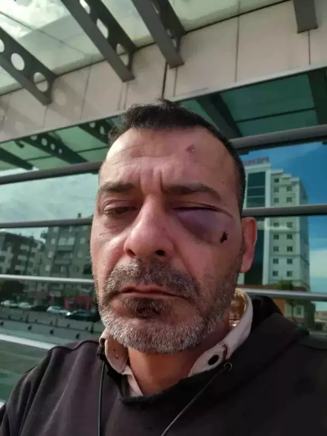 Ünlü fenomene eşi ve ailesinden öldüresiye dayak