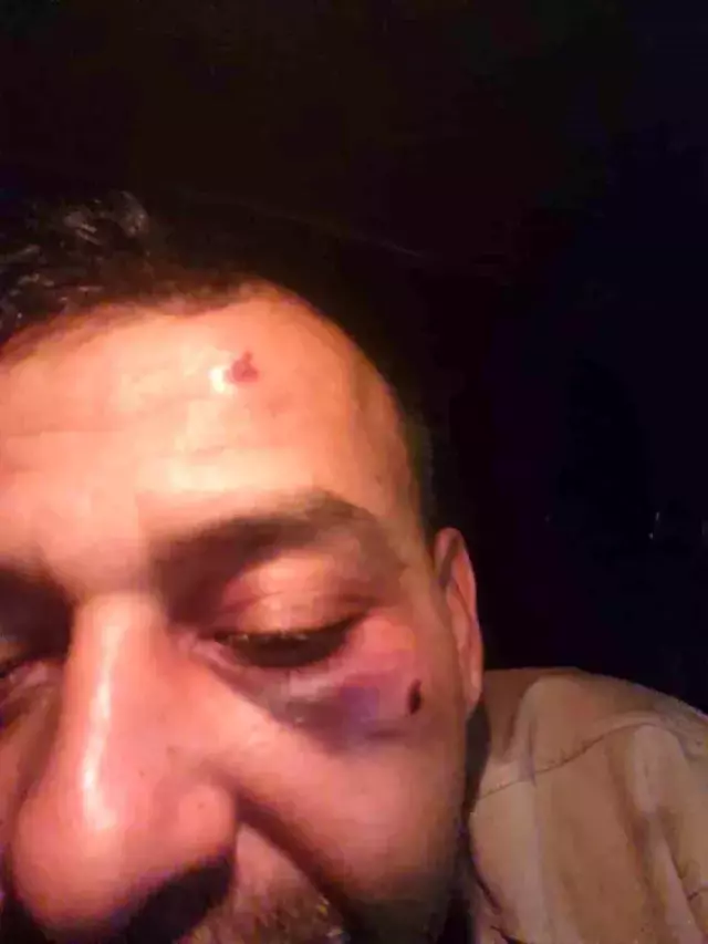 Ünlü fenomene eşi ve ailesinden öldüresiye dayak