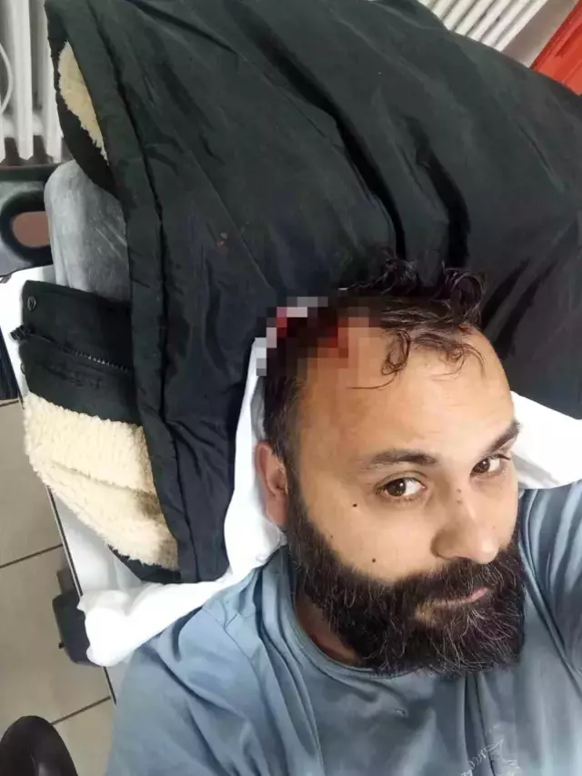 Ünlü fenomene eşi ve ailesinden öldüresiye dayak