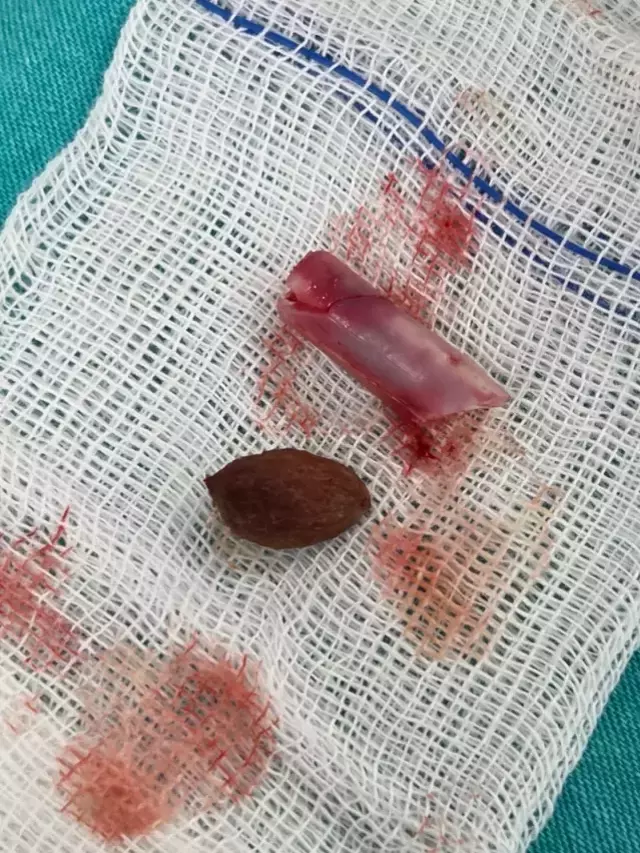 Kaşıntı şikayetiyle gitti, burnundan çıkanlar akıl alır gibi değil