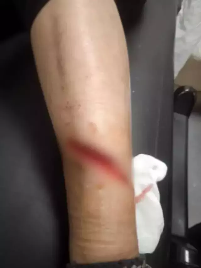 Sokak köpeklerinin saldırısına uğrayan kadın yaralandı