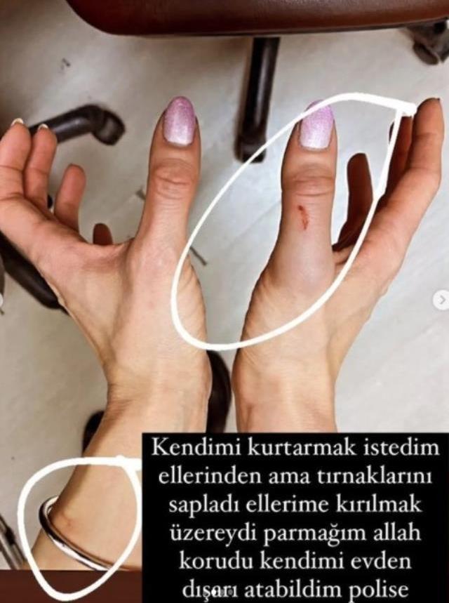 Kanlar içinde kalan eşinin iddialarına Özer Hurmacı'dan olay cevap: Hepsi yalan