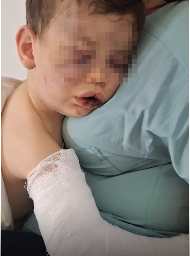 Denizli'de 2 Yaşındaki Bebek Annesinin Erkek Arkadaşı Tarafından Dövüldü