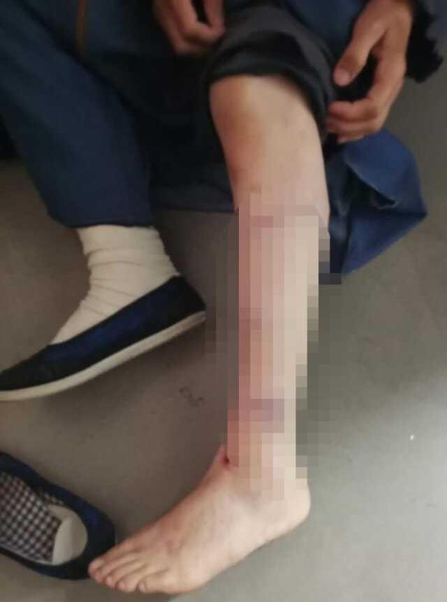 İmamoğlu'nun danışmanı Murat Ongun'un 'Thor' isimli köpeği belediye çalışanına saldırdı