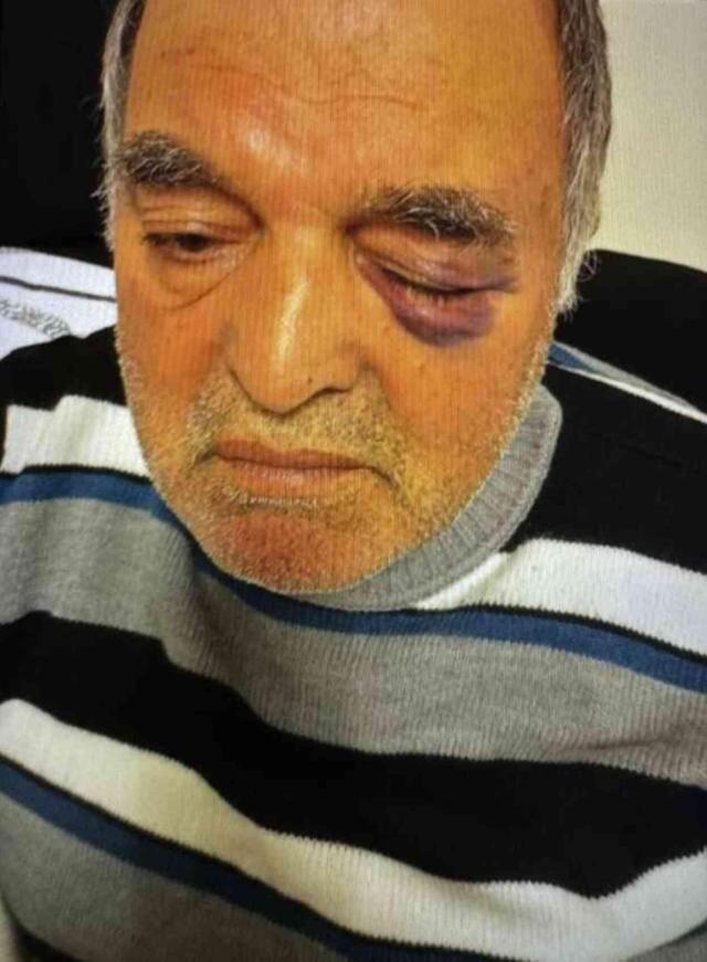 Okul Müdürünün Darp Ettiği Çift İHA'ya Konuştu